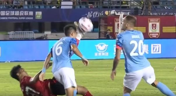 开云网站-新鹏城官方：廖力生鼻骨粉碎性骨折，目前已顺利完成手术